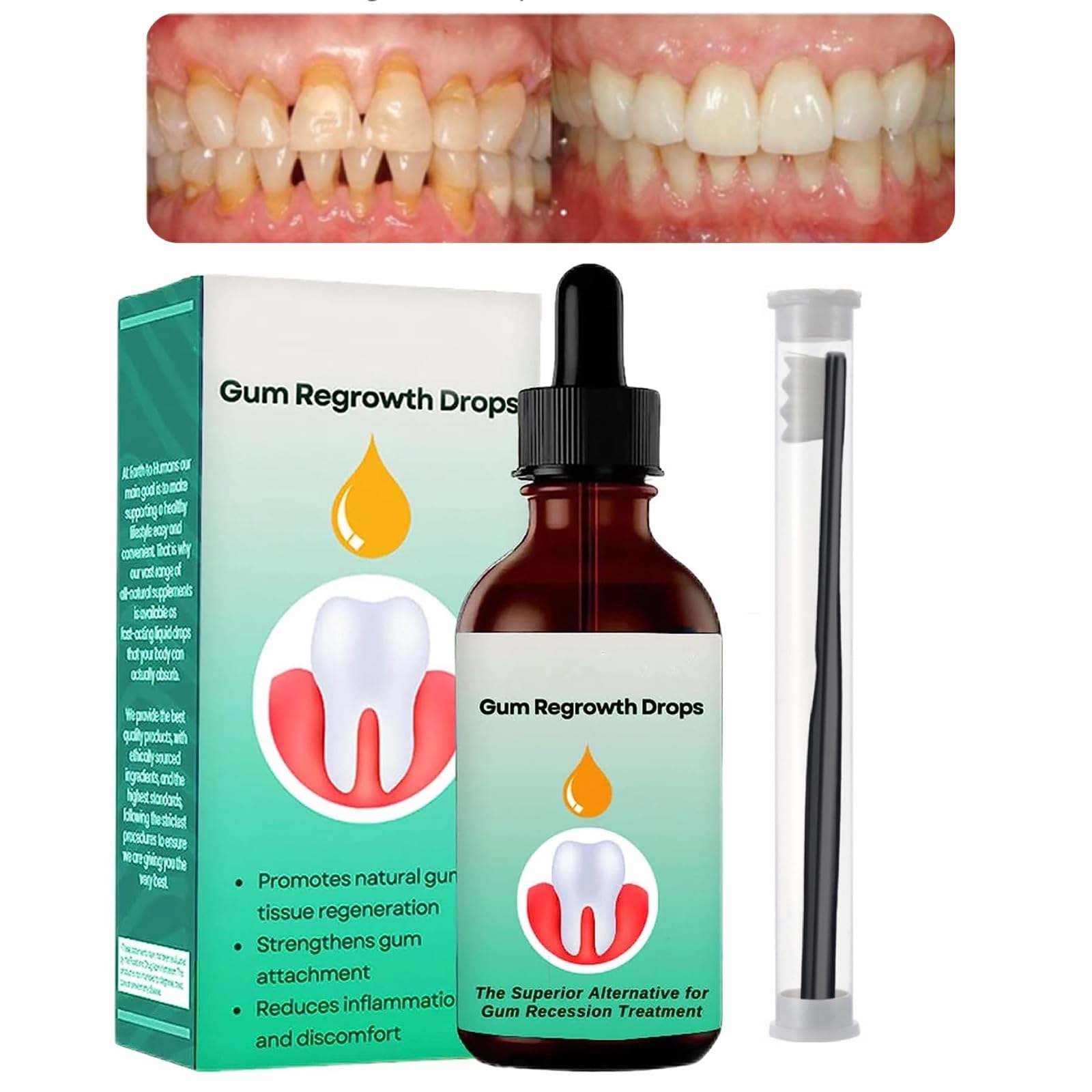 Buy DentiZen Gum Regrowth Drops, Gum for Receding Gums, Oil Pulling for
