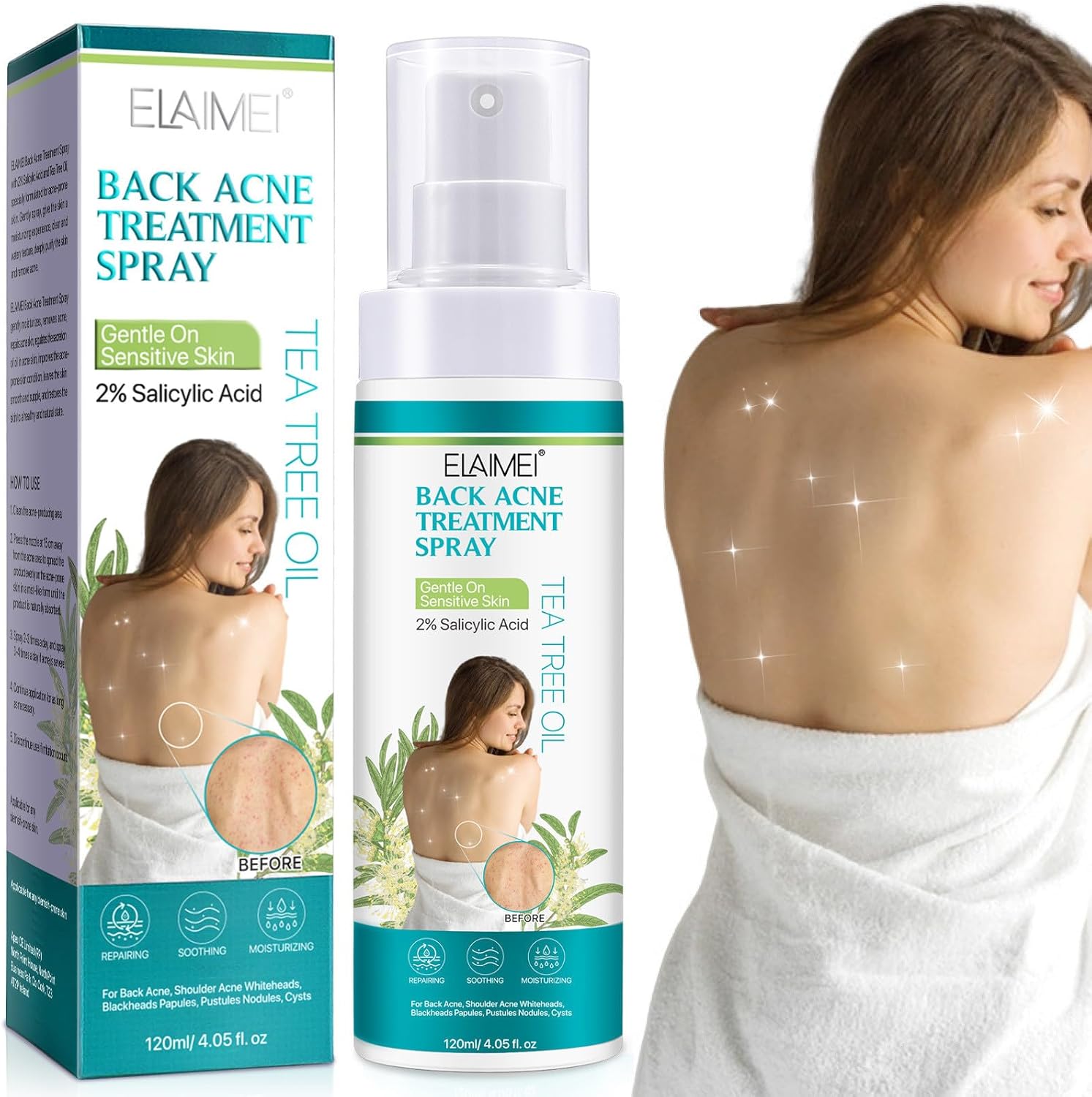 Acne Back-acne spray, acne-behandelingsspray, acne spray voor rug en lichaam, theeboomolie voor rug, acne-oplossing, 120 ml