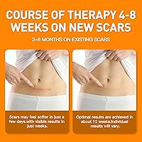 Vista 6 de Hojas de silicona para cicatrices (1.6 x 120 pulgadas), rollo de cinta de silicona médica para cicatrices, tiras, parche, vendaje, tratamiento