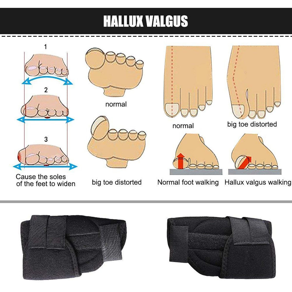 PEDIMENDTM Zehenglätter und Korrekturhilfe für Hallux Valgus Schmerzlinderung (2 Paar)