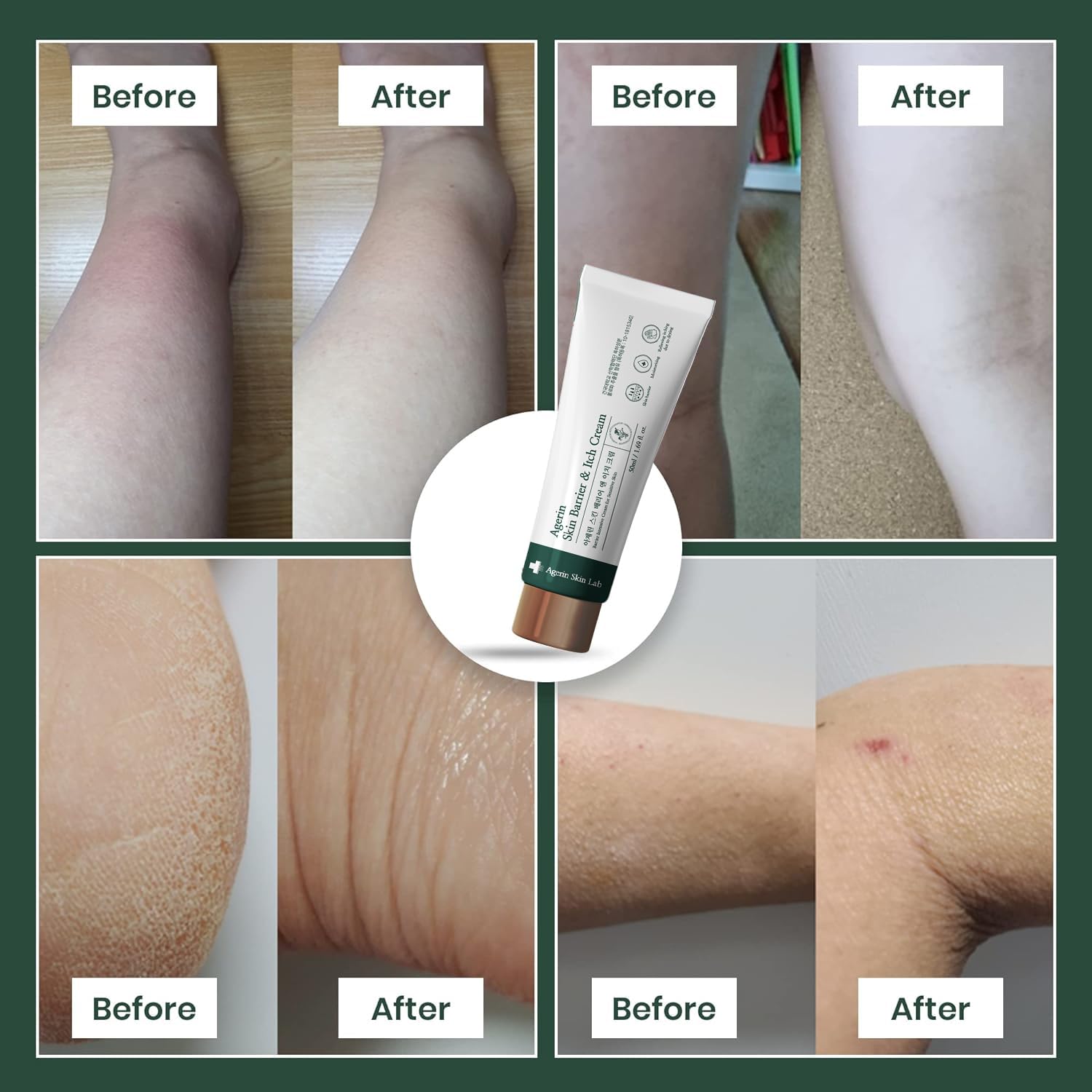 Anti-Itch Cream – Skin Barrier and Itch Relief Cream for Sensitive and Dry Skin, Trouble Care, Calming, Hydrating, Purifying, Cruelty Free, Vegan