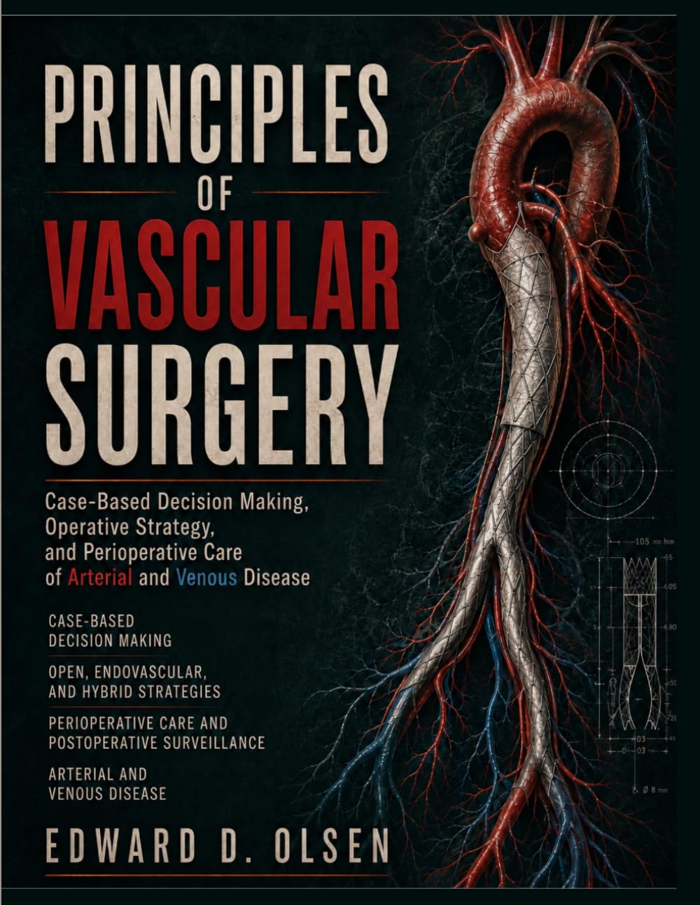 Principles Of Vascular Surgery: Case-Based Decision Making, Operative Strategy, and Perioperative Care of Arterial and Venous Disease
