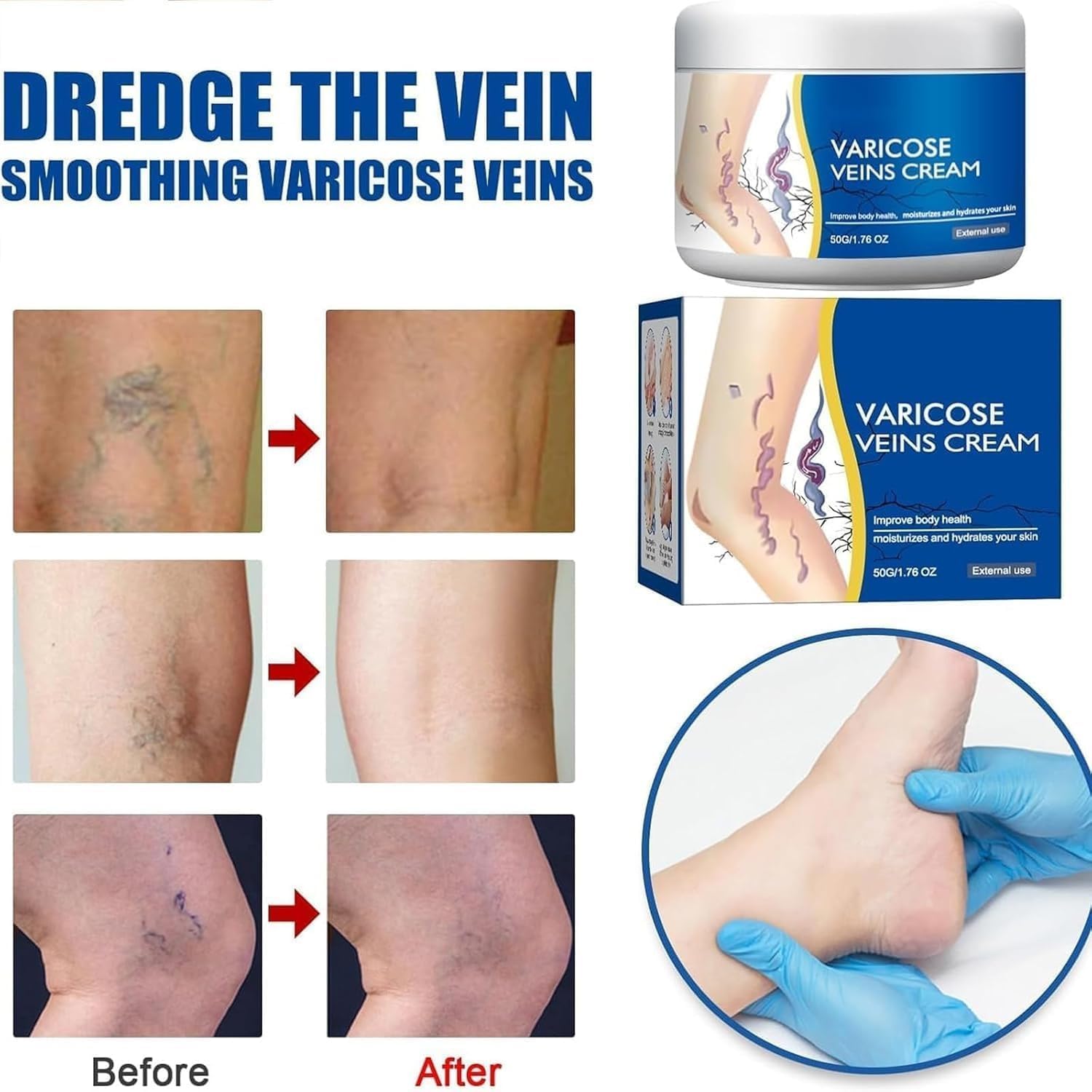 Varicose Veins Relief Cream | Herbal Formula with Horse Chestnut, Witch Hazel & Menthol | Soothes Swelling, Spider Veins & Leg Fatigue | Fast-Absorbing, Non-Greasy Lotion (50gm, Pack of 1) — Amazon image 4