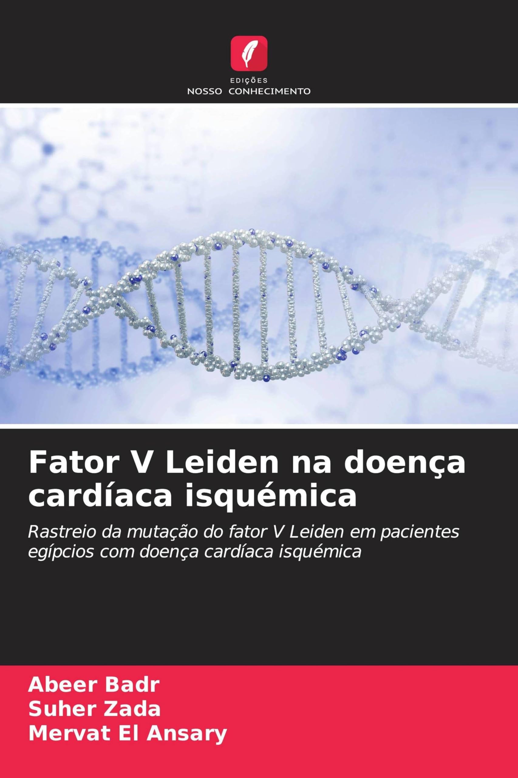 Fator V Leiden na doença cardíaca isquémica: Rastreio da mutação do fator V Leiden em pacientes egípcios com doença cardíaca isquémica