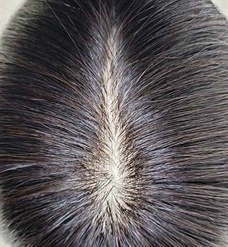 総手植え全頭かつら 人毛100%EM-50001ダークブラウン Ｌサイズ 医療用 楽天市場】【試着可能 返品OK】 楽天1位 部分ウィッグ かつら 人