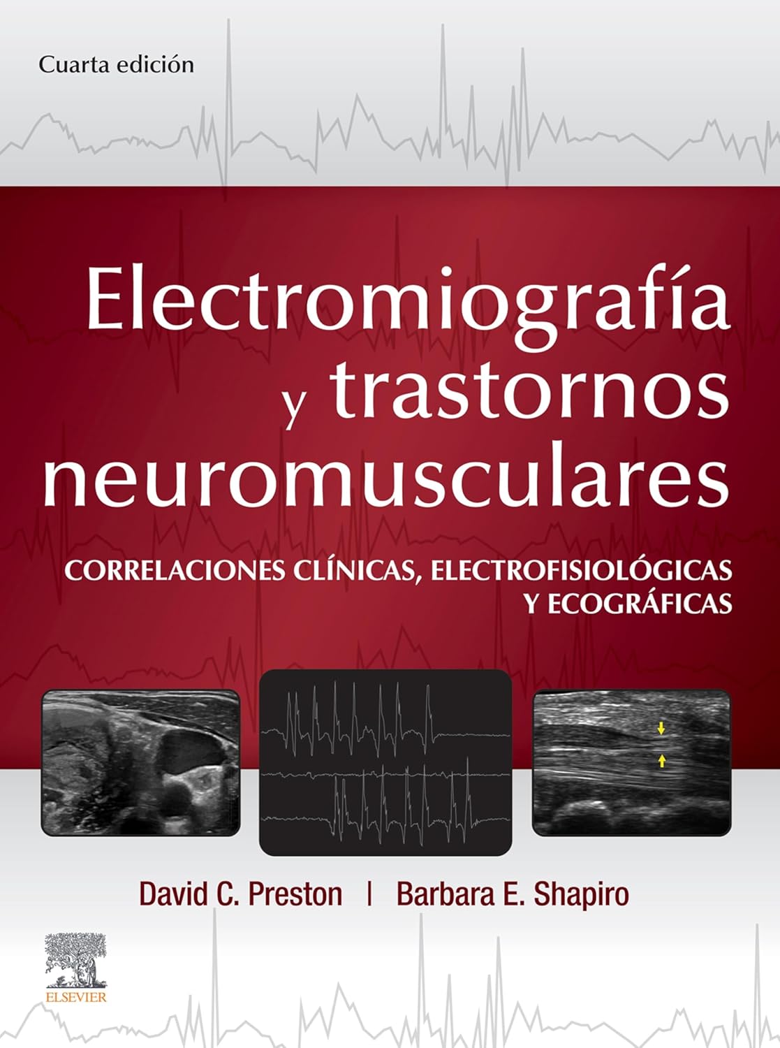 Electromiografía y trastornos neuromusculares: Correlaciones clínicas, eletrofisiológicas y ecográficas (Spanish Edition)      Kindle Edition with Audio/Video