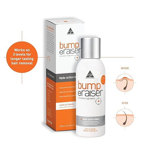 Miniatura 7 de Loción calmante de triple acción para el tratamiento del cabello encarnado, protuberancias de afeitar y quemaduras de maquinilla de afeitar