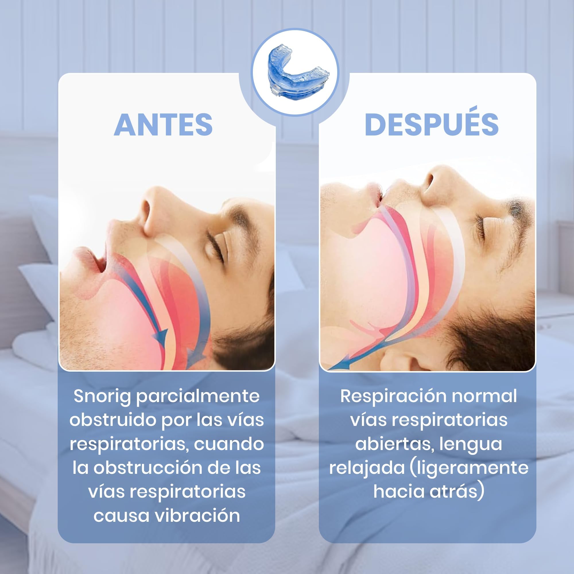 Férula Antirronquidos de Avance Mandibular Ajustable Termomoldeable para Reducir Ronquidos y Bruxismo