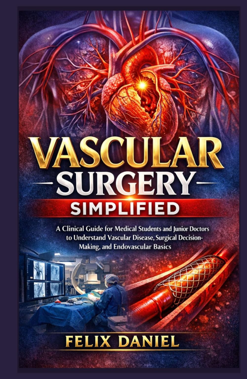 Vascular Surgery Simplified: A Clinical Guide for Medical Students and Junior Doctors to Understand Vascular Disease, Surgical Decision-Making, and Endovascular Basics