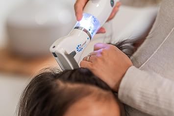V-Comb Supra - Head Lice and Egg Remover - Pesticide and Chemical Free - 100% Natural Treatment