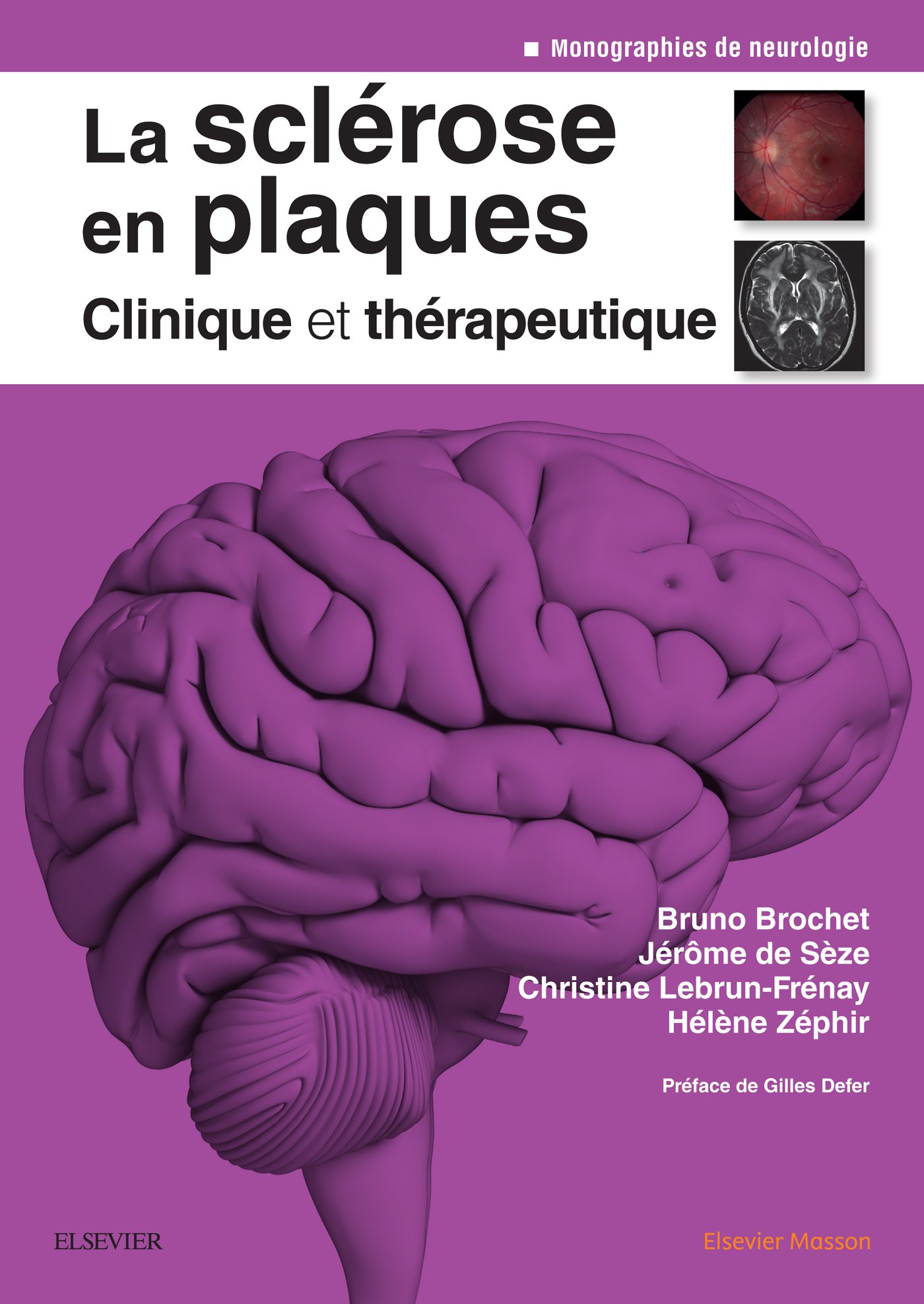 La sclérose en plaques - Clinique et thérapeutique (Neurologie) (French Edition)