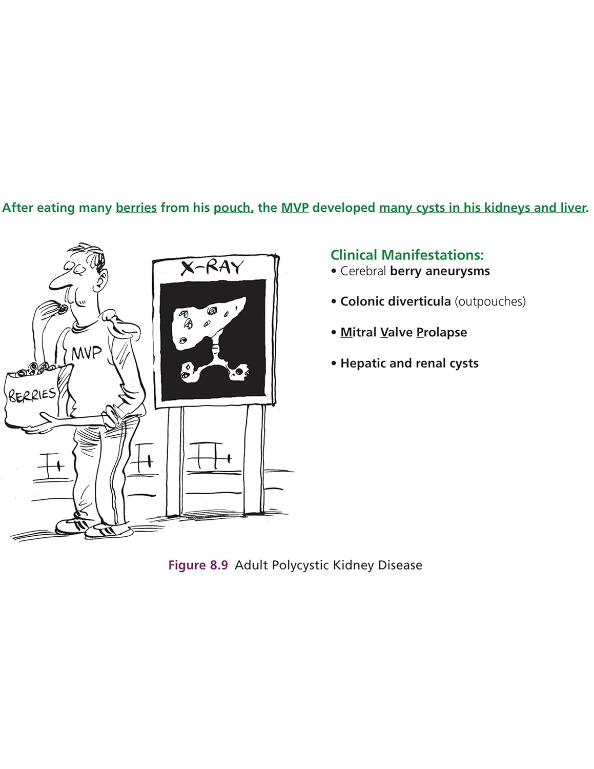 The Ultimate Medical Mnemonic Comic Book: 150+ Cartoons and Jokes for Memorizing Medical Concepts (Kaplan Test Prep)