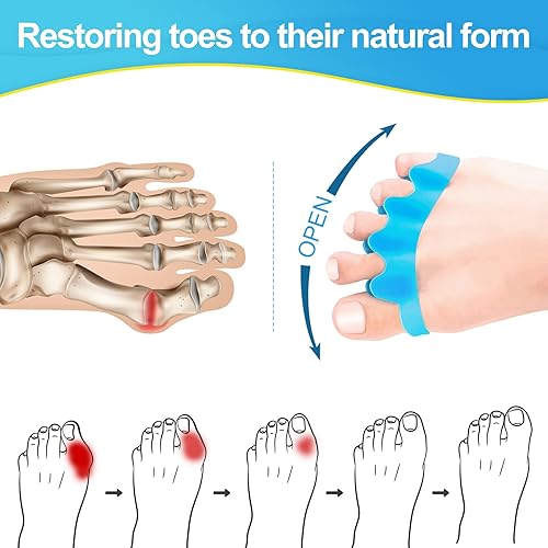 Miniatura 2 de 8 separadores profesionales de dedos de los pies. Separadores de dedos de silicona Juzure para corregir juanetes y restaurar los dedos de los pies a