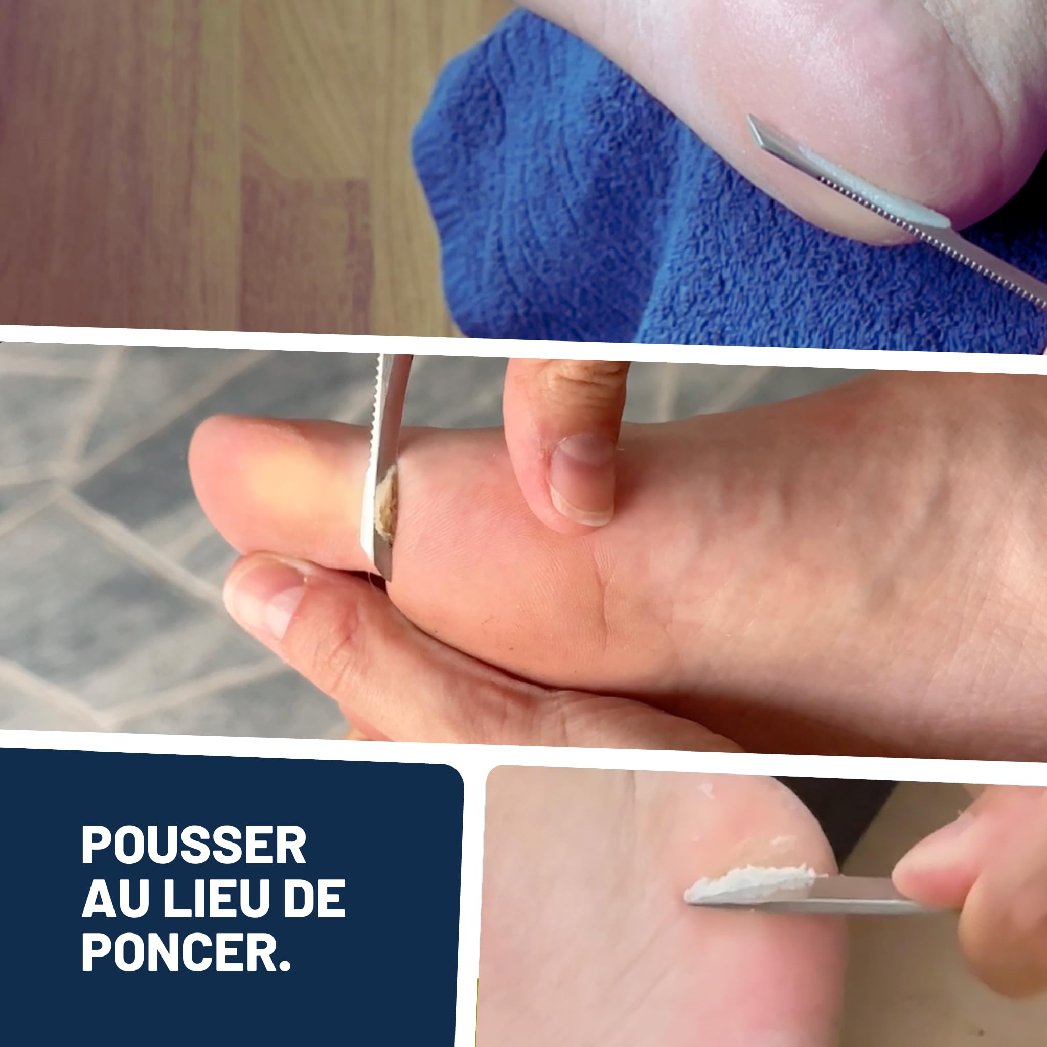 Mr. Fuss® Solution No. 4 pour enlever la callosité - adoucissement rapide - 250ml Advanced Pack Basic - contre la peaux mortes y les cuticules avec effet immédiat en 10 minutes