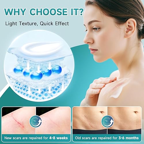 Miniatura 5 de Crema avanzada para cicatrices, gel de silicona para cicatrices, crema profesional para eliminar cicatrices quirúrgicas, estrías, cicatrices viejas