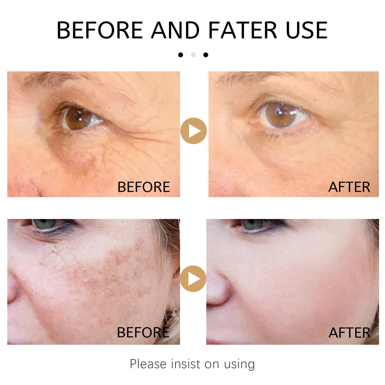 Vitamin C & Turmeric Face Serum For Aging & Wrinkles, Oil With 20% Vitamin C, Improves Dark Spots & Fine Lines - Image 3