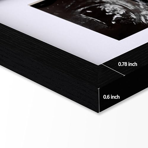 Miniatura 5 de eletecpro Marco de fotos de ultrasonido, para pantalla de fotos de ecografía de 3 x 4, marcos de fotos de sonograma para anuncio de embarazo,