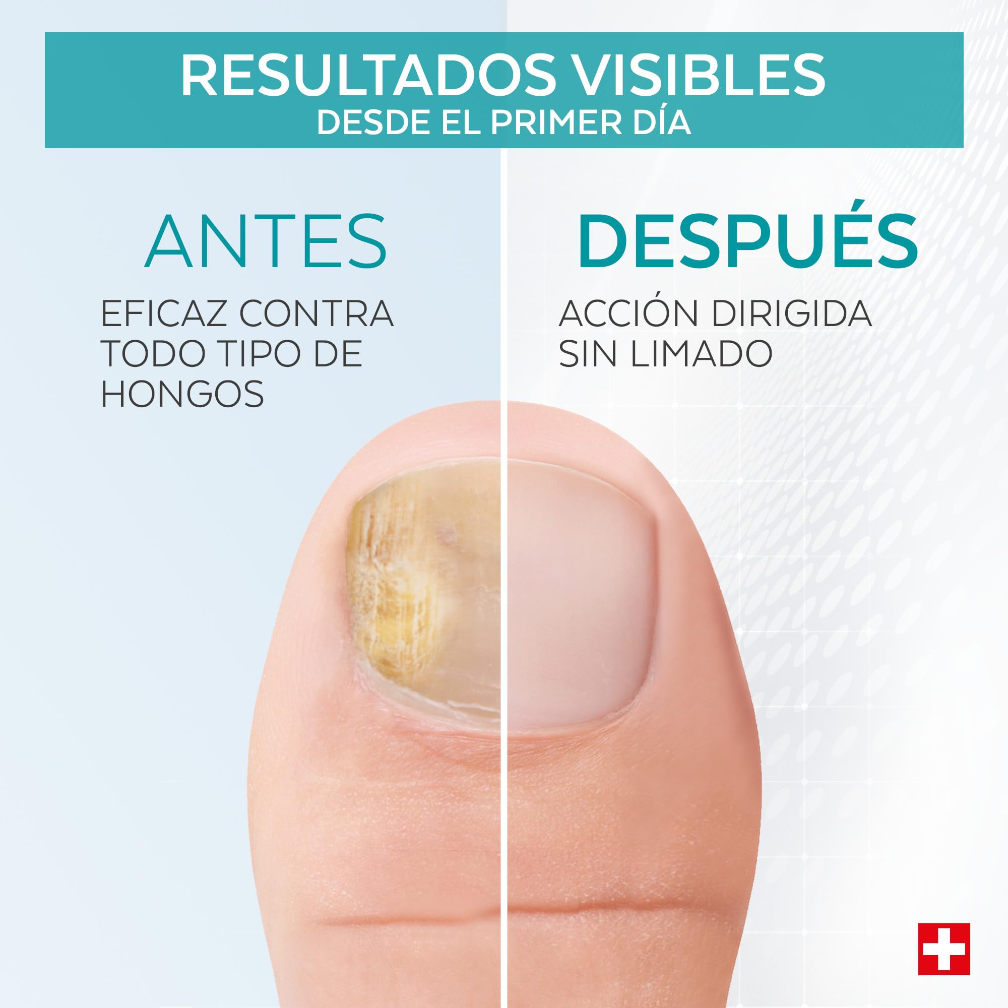 Poderm Lápiz Sérum para Hongos en las Uñas – Desarrollado por un Podólogo – Fabricado en Suiza – Supplend Lápiz para el Cuidado de Uñas de Manos y Pies – Tratamiento para Hongos y Uñas Dañadas