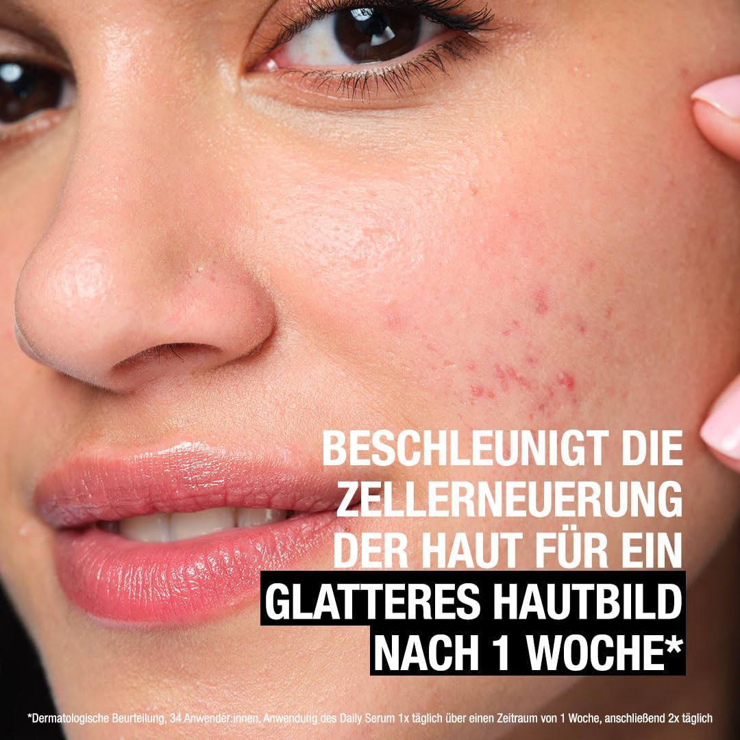 Neutrogena Środek przeciw pryszczom + Liquid Exfoliant do pielęgnacji twarzy, płynny peeling z 7% AHA + pantenol 125 ml delikatnie usuwa obumarły naskórek i nadmiar łoju