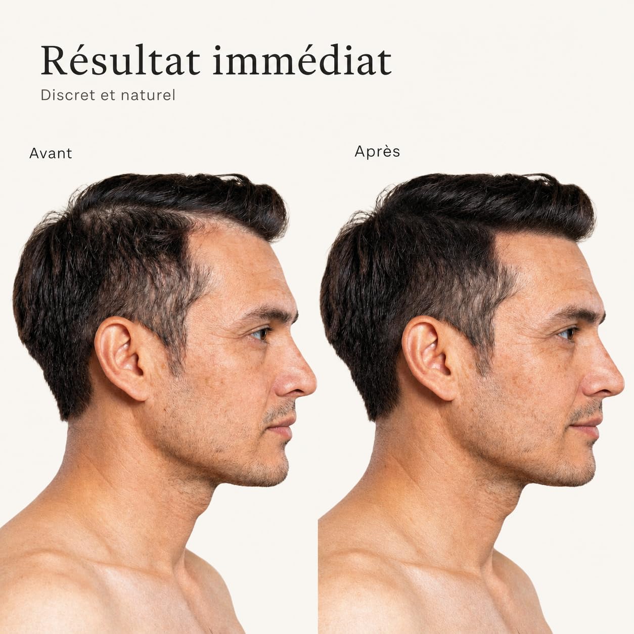 Avey Polvere densificante per capelli – Fibre per capelli naturali di cotone – Cammula le zone sparse – Effetto naturale – 27,5 g (castano medio)