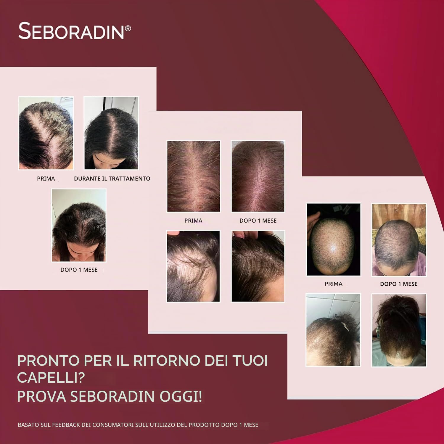 Seboradin Forte Fiale Siero Per La Crescita Dei capelli Per Donne Uomini Vitamine Estratti Naturali Per il Cuoio Capelluto 14 x 5,5 ML