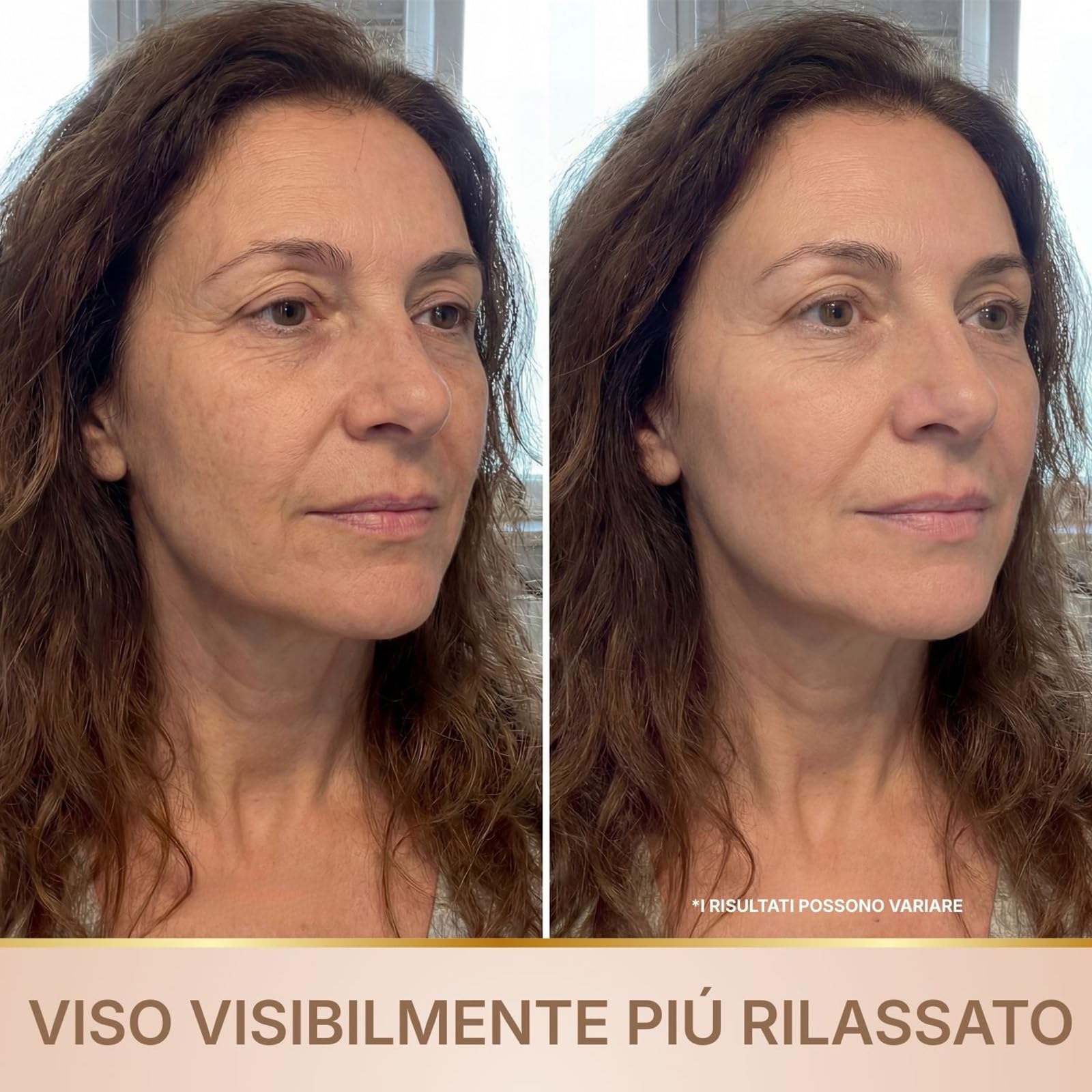 Biochroma Siero Coreano Effetto Lifting Dalla Prima Applicazione 2Pack, Siero Con Peptidi Di Seta E Collagene, Attenua Le Rughe, Idrata In Profondità, Consistenza Leggera 30 Ml