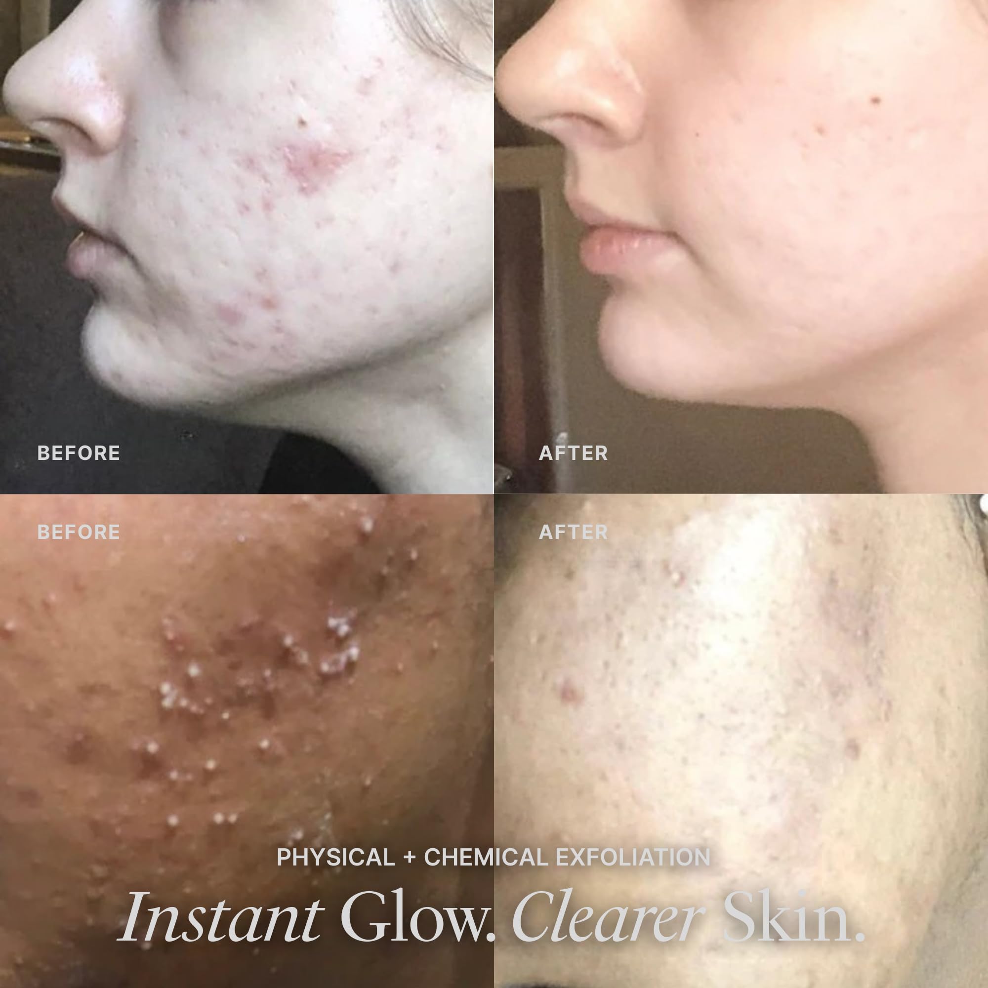 Vasanti Cosmetics Brighten Up. Enzymatic Face Rejuvenator with Microderm Exfoliating Crystals – Treats Dull, Uneven Skintone