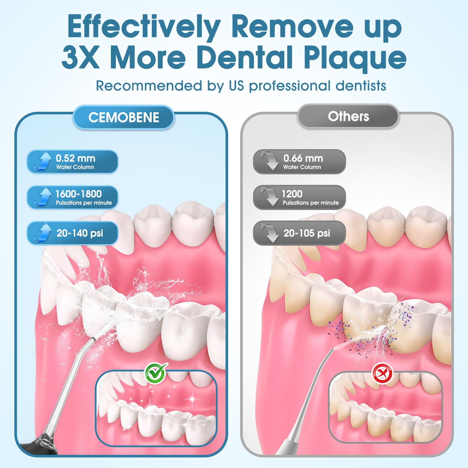 Irrigador bucal recargable de 300 ml, IPX7, impermeable, inalámbrico, portátil, con 4 modos y 6 puntas de chorro reemplazables, limpiador profesional de hilo dental para uso diario en el hogar, viajes