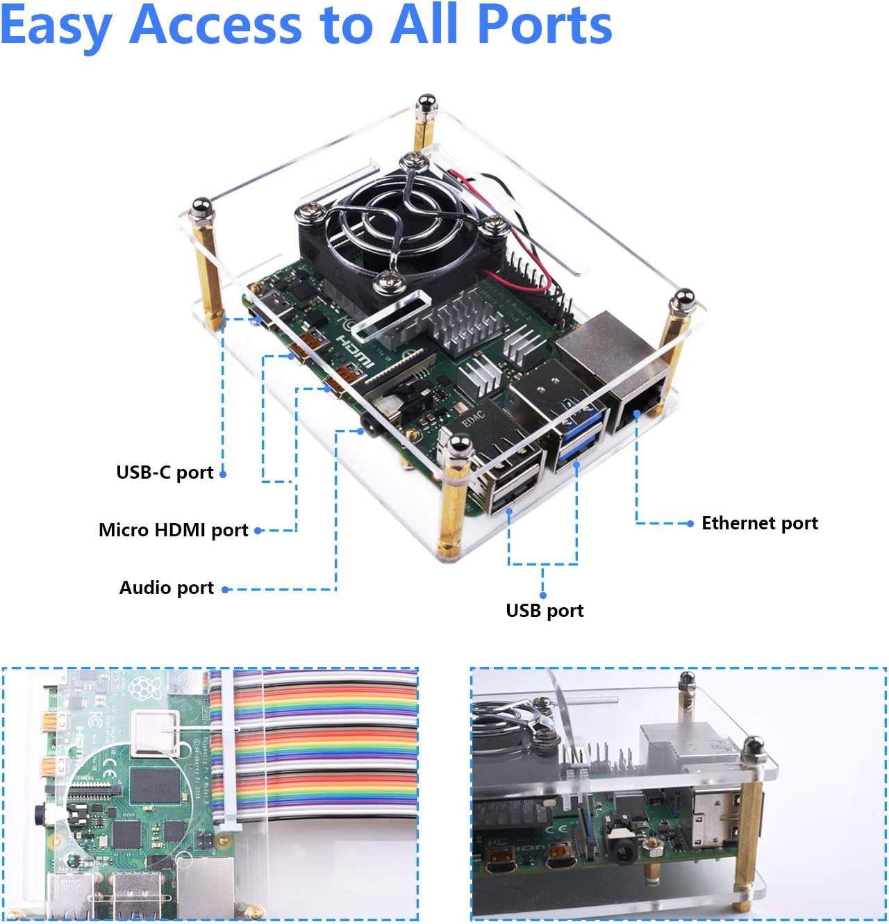 Smraza Case for Raspberry Pi 4, Acrylic Case with Cooling Fan, Heatsinks Compatible with Raspberry Pi 4 Model B, for Raspberry pi 3 B+/ 3B/ 2B Clear (Big Fan(35mm) with Power Supply)