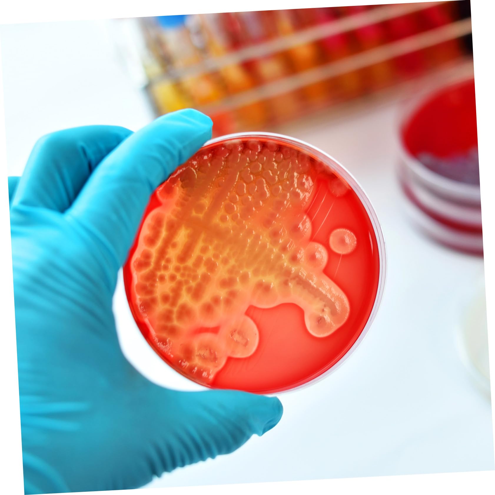 SHINEOFI 20 piezas Unidades Placas Petri de Agar Nutritivo Prefabricadas para Cultivo Microbiológico Escolar y Laboratorio con Gruesa de Agar para Crecimiento Rápido