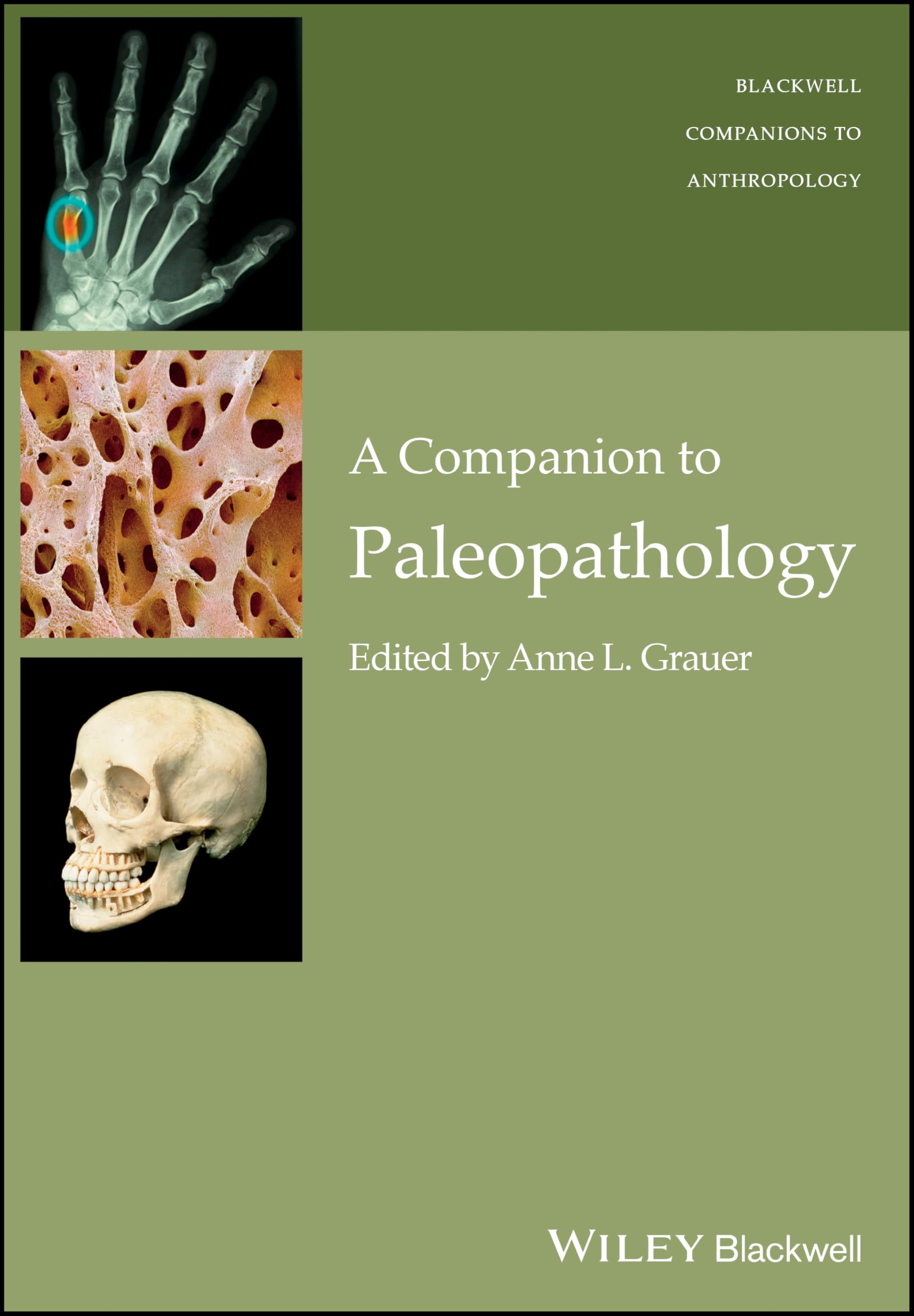 A Companion to Paleopathology (Wiley Blackwell Companions to Anthropology)