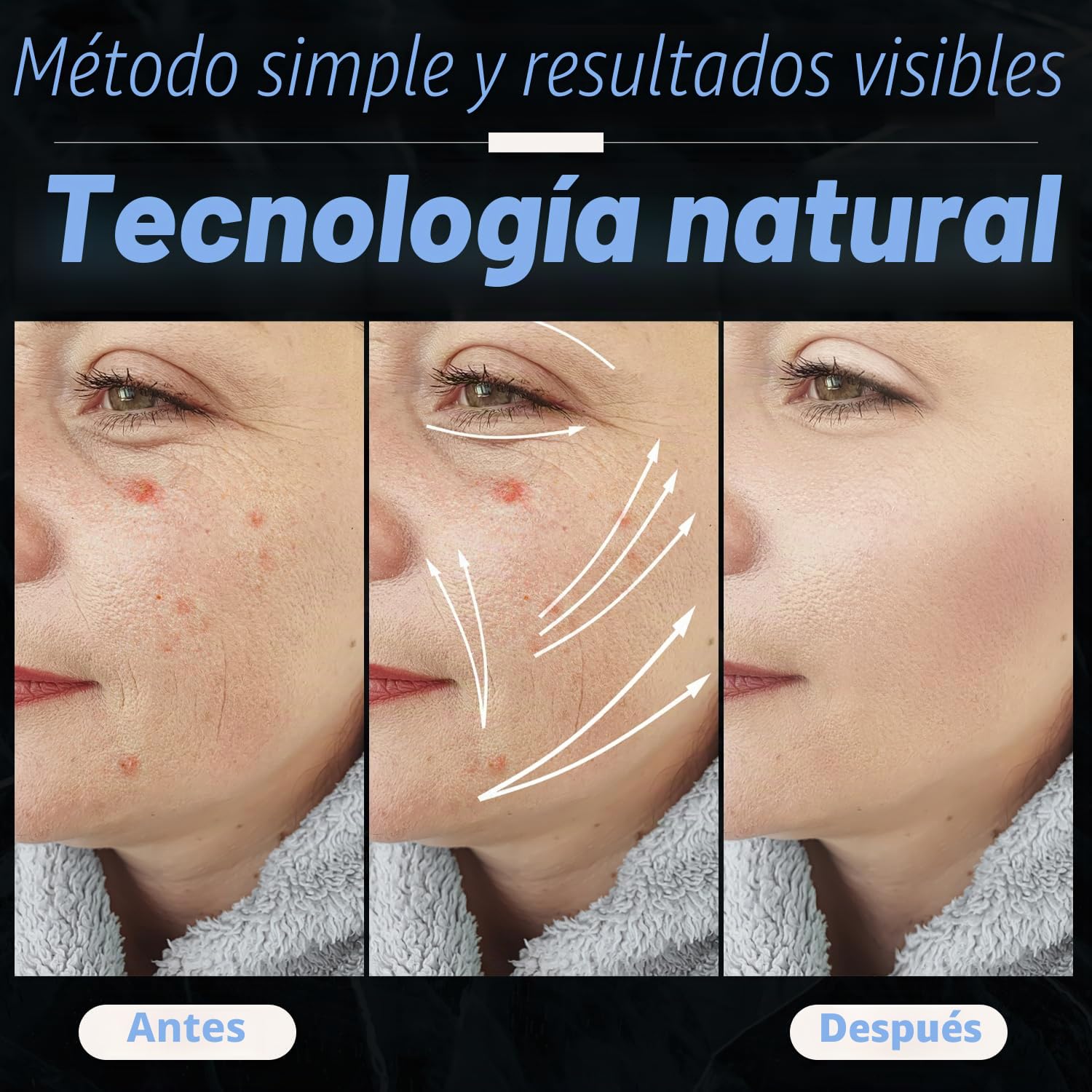 UUPAS 4 en 1 Azul Máquina Facial de Alta Frecuencia Profesional - Dispositivo de Estiramiento de la Piel