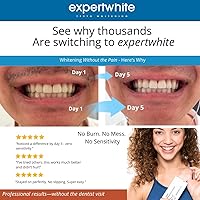 Vista 5 de Tiras blanqueadoras dentales: 12% alimentadas con peróxido, tira flexible Pro Advanced de ajuste seco, pH equilibrado, seguro de esmalte, cero