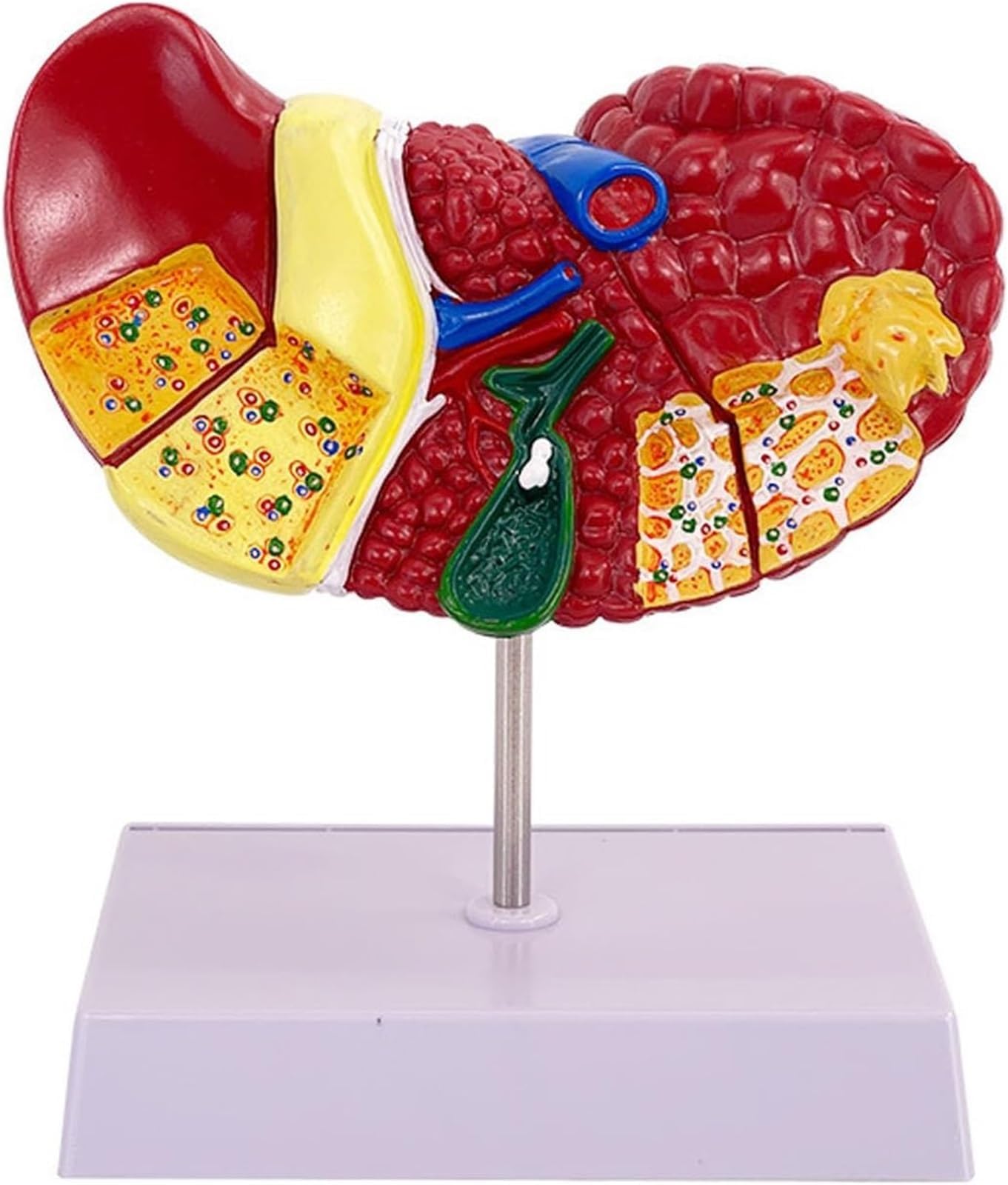 Human Liver Model Anatomical Pathology Liver Model with Base and Clear Texture and Pathological Features Liver Cirrhosis Model for School Study and Research