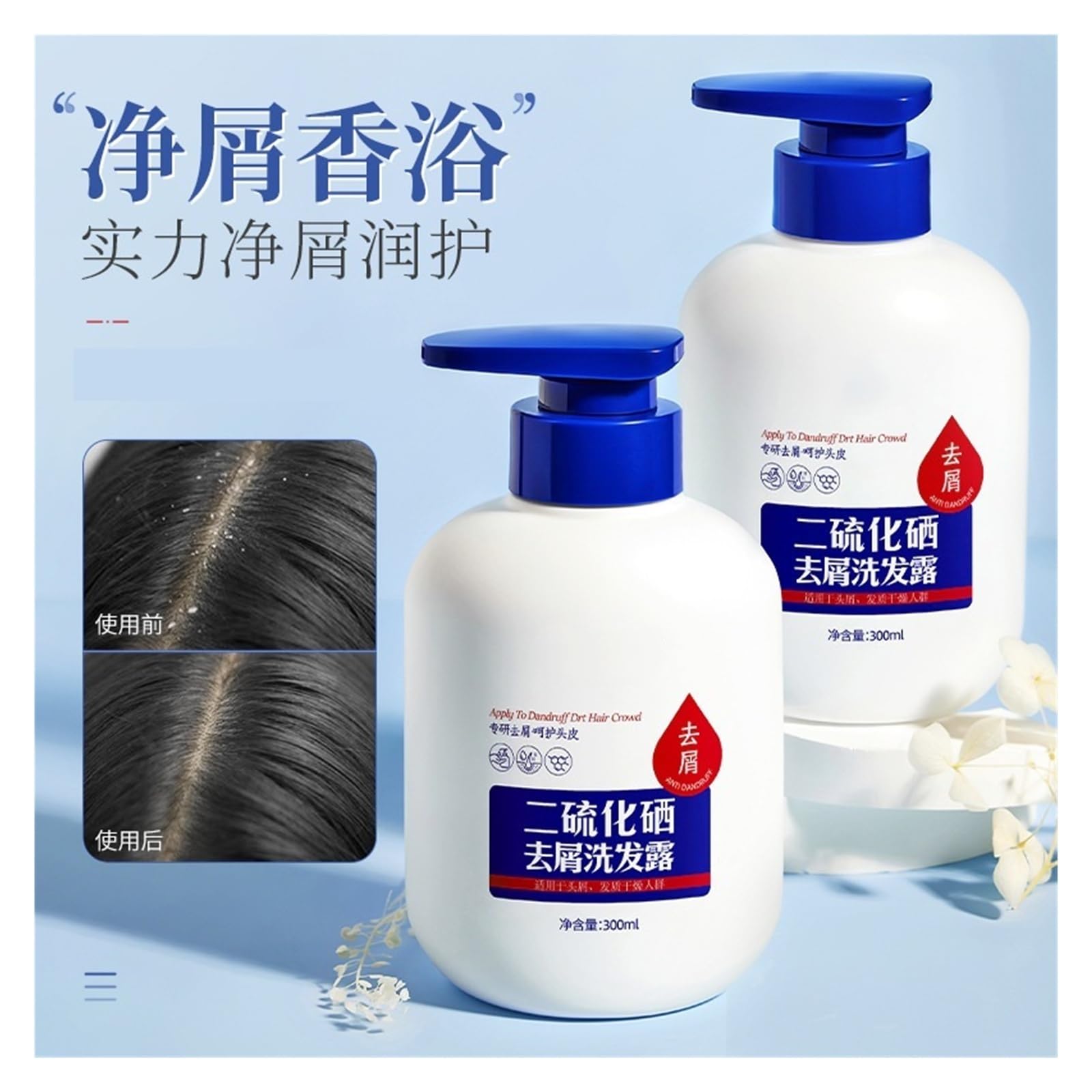 Tiefenreinigendes Schuppenshampoo | Die sanfte Reinigungsformel verbessert das Kopfhautmilieu(2pcs)