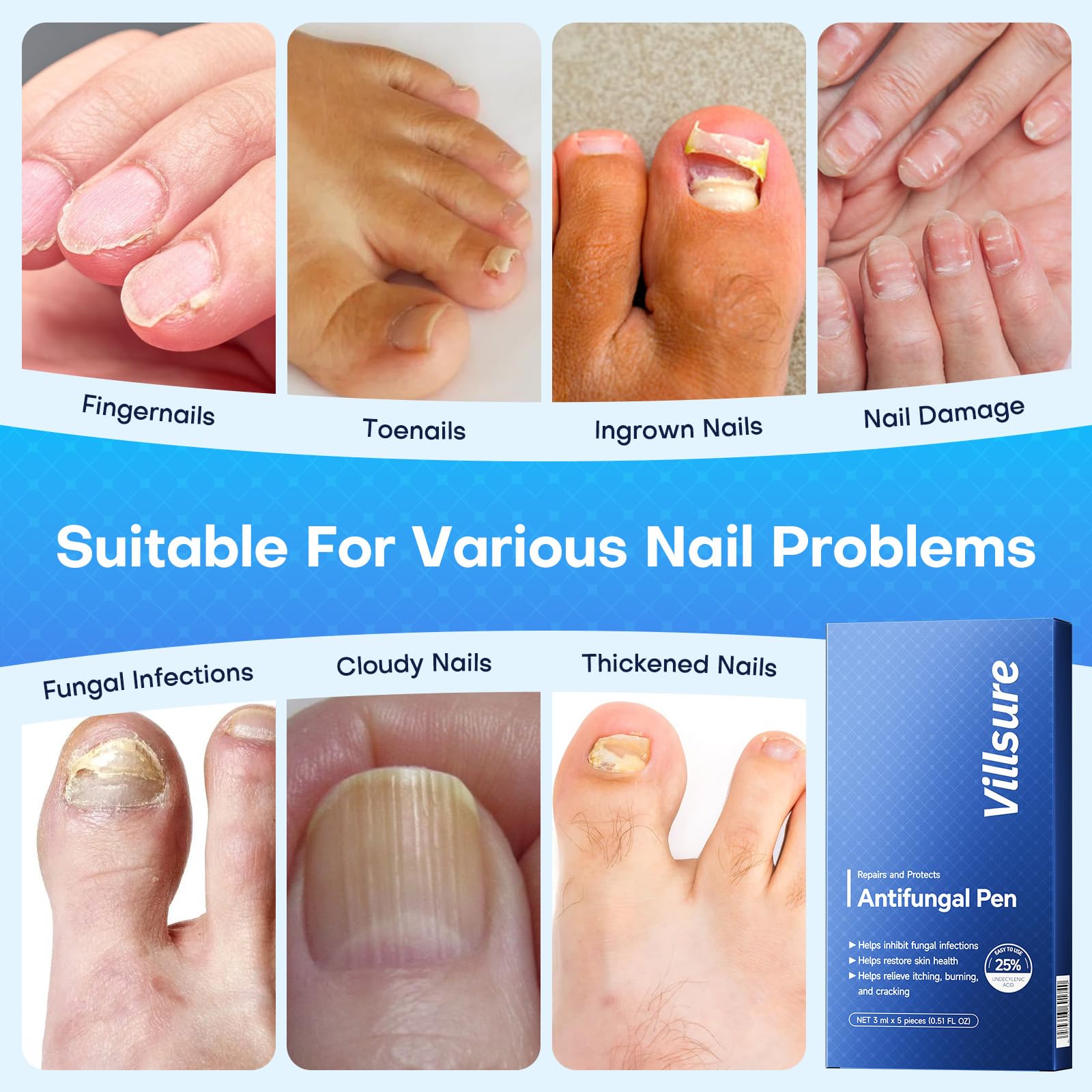 Toenail Fungus Treatment Extra Strength Pen with 25% Undecylenic Acid 5 Pcs — Amazon image 5