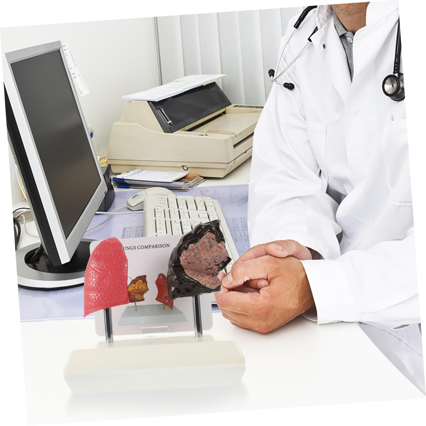 Unomor 1Pc Smoking Lung and Lung Comparison Model Detailed Anatomy Model for Medical Teaching Material for Educational Presentations and Workshops