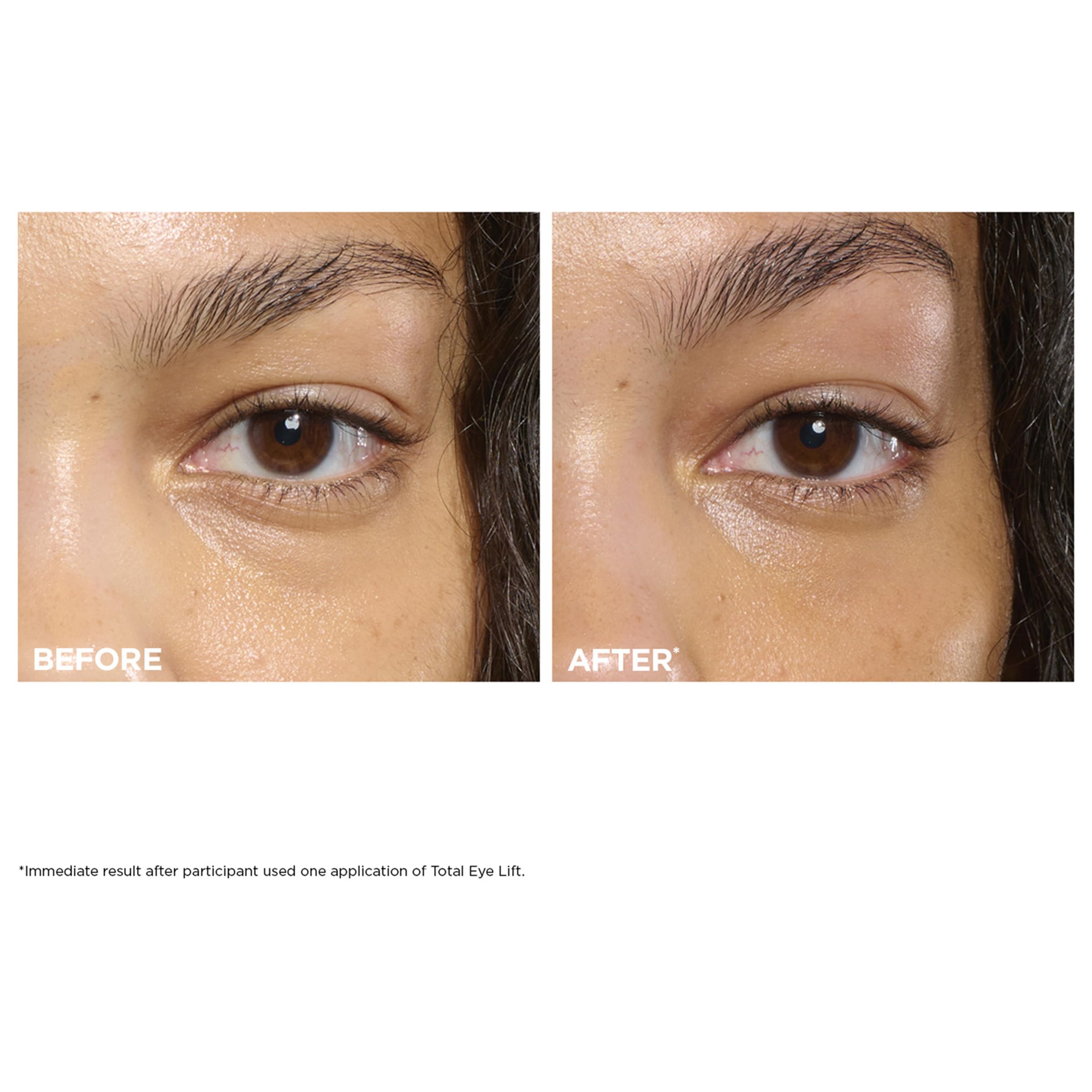 Clarins NEW Total Eye Lift | Anti Aging Eye Cream | Targets Wrinkles, Crow's Feet, Dark Circles and Puffiness For a Visible Eye Lift in 30 Seconds | REFILLABLE