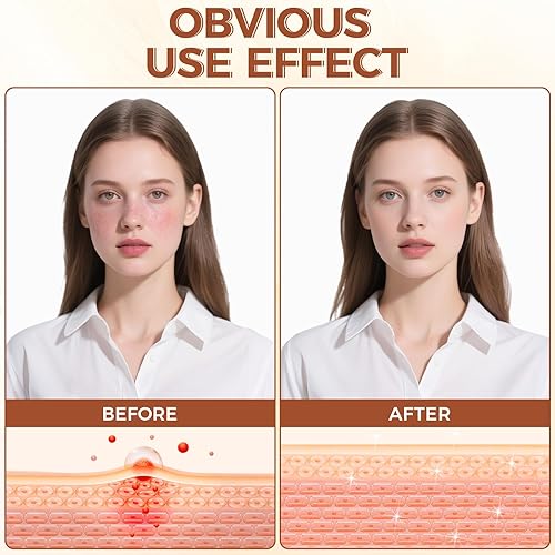 Miniatura 3 de Sarga de ternera para la piel, bálsamo de miel y bálsamo para la cara, hidratante facial de ternera alimentada con pasto orgánico para nutrir