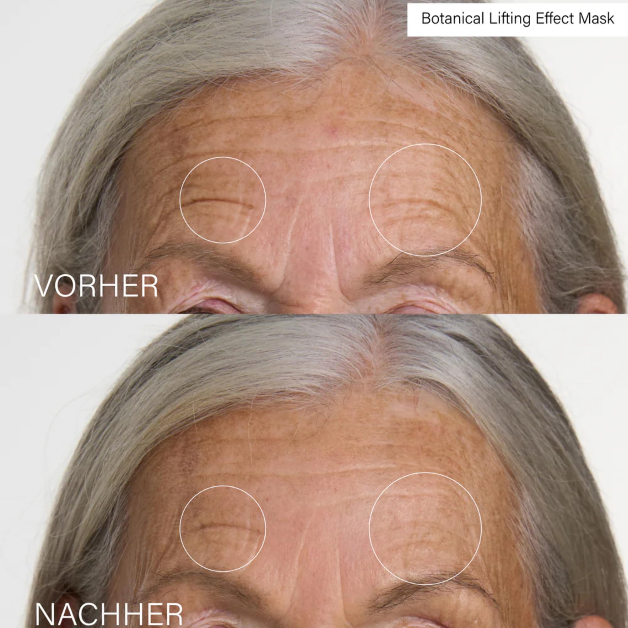 Rosental Microneedling Lifting Effect Set – Gesichtspflege Set mit Microneedling Effect Treatment 30 ml, Lifting Serum 30 ml & Maske 50 ml – für ein glatter wirkendes Hautbild