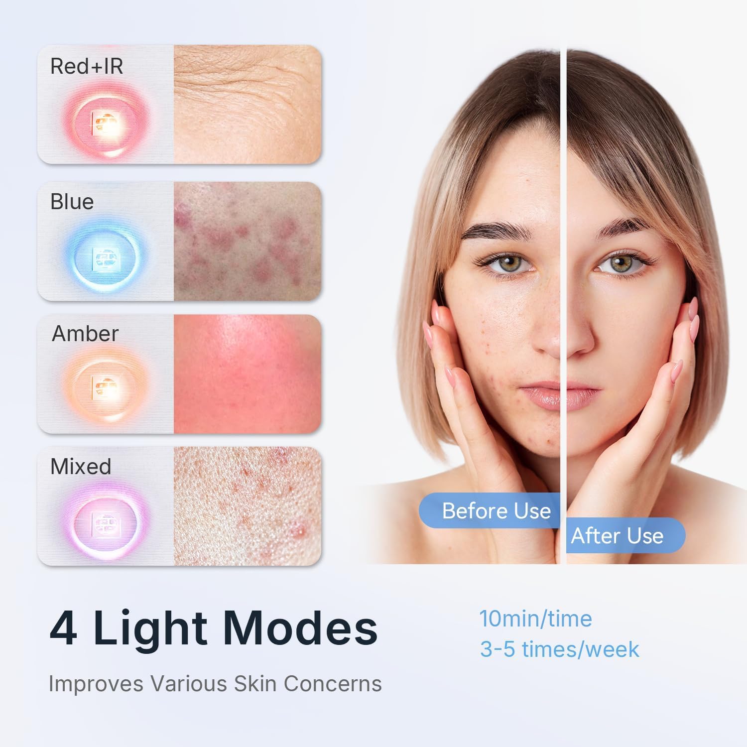 Máscara LED Facial 4 en 1 - Terapia de Luz Roja e Infrarroja Aprobada por la FDA - Dispositivo de Fototerapia Profesional para Acné y Arrugas, Cuidado Facial y Corporal (Azul)