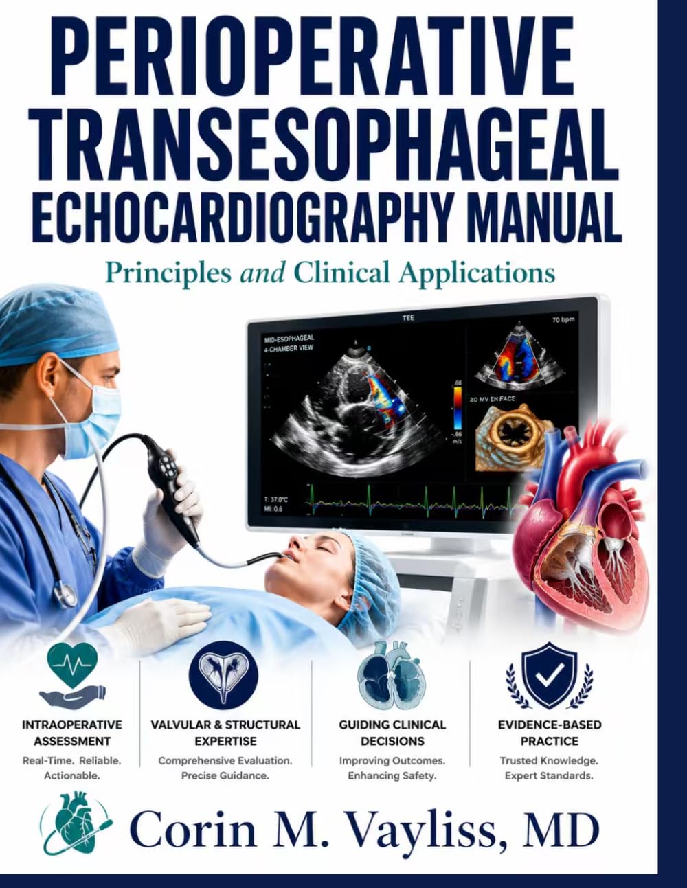PERIOPERATIVE TRANSESOPHAGEAL ECHOCARDIOGRAPHY MANUAL: Principles and Clinical Applications