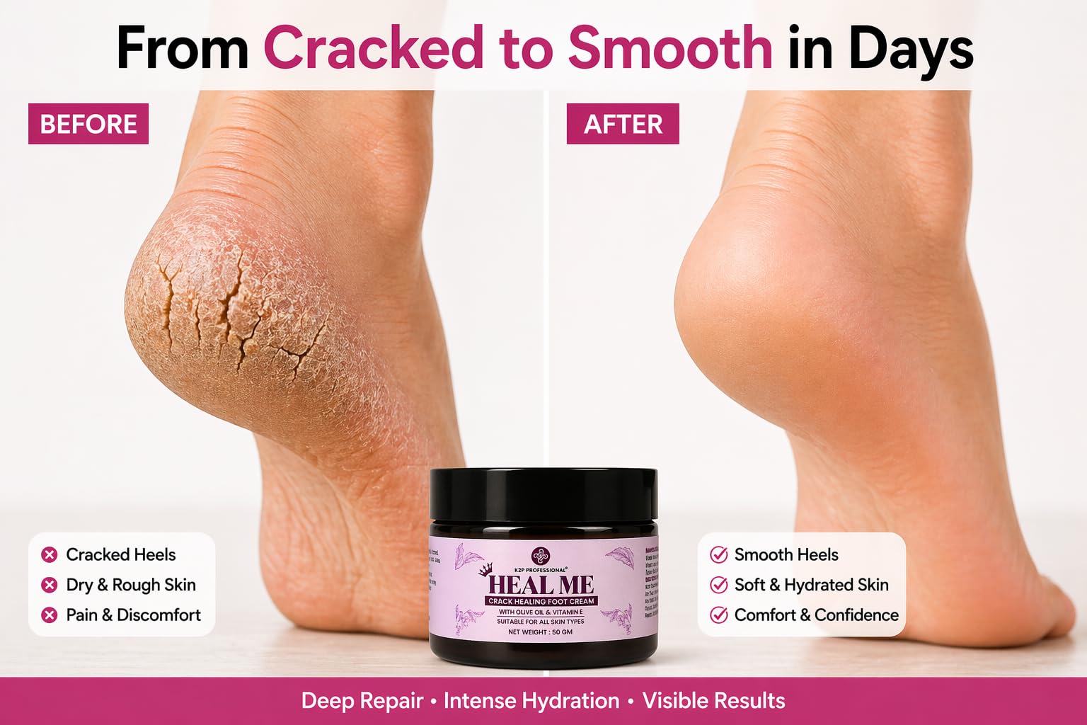 K2P HEALME Crack Healiso Foot Cream for Cracked Heels | Deep Moisturizing Heel Repair with Olive Oil & Vitamin E | Soft & Smooth Feet Care | Dry, Rough Heel Treatment | 50g