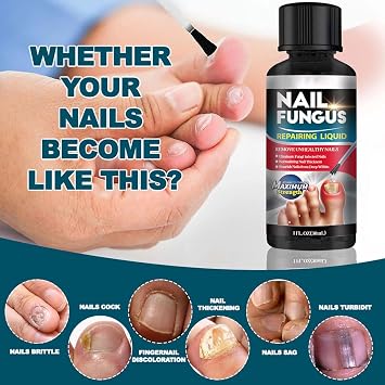 Extra Strong Fungal Nail Treatment for Toenails & Fingernails Formula Extra Strong Antifungal, Repair & Renew Thick, Damaged Nails, Strengthen & Fix Fungal Nails to Restore Healthy Nails, 30 ml