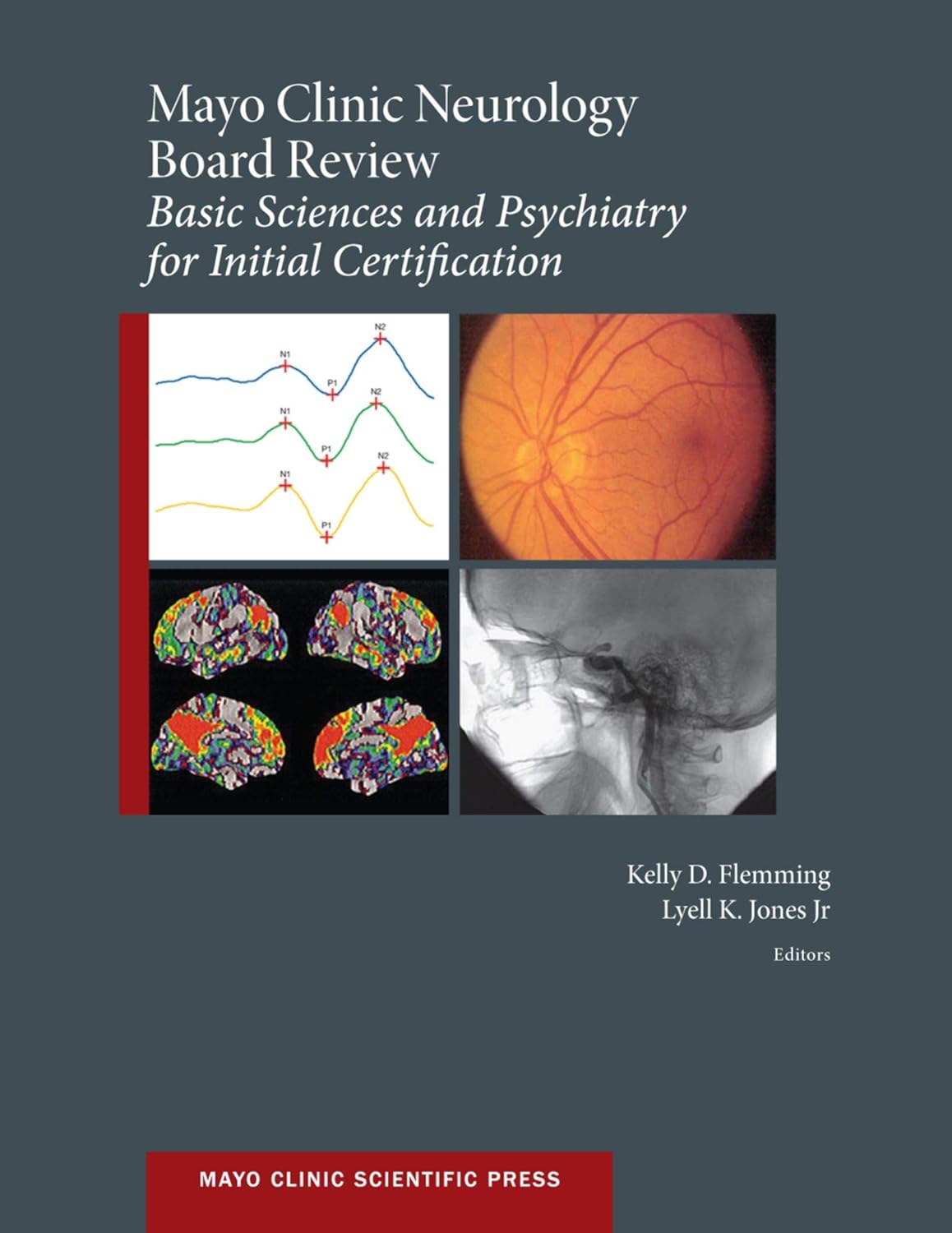 Mayo Clinic Neurology Board Review Basic Sciences and Psychiatry for Initial