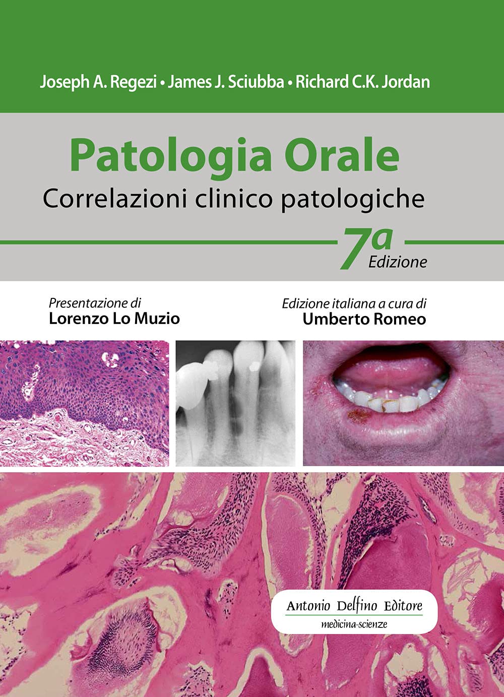 Patologia Orale. Correlazioni Clinico-Patologiche. Con Espansione Online - 4
