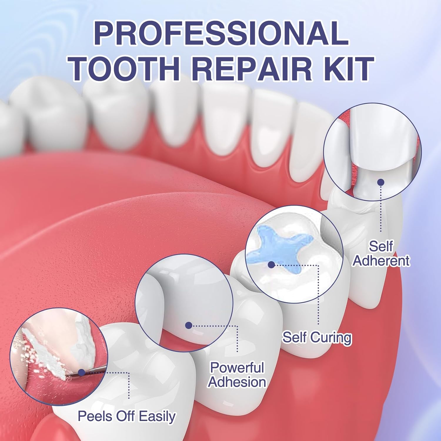 Zinc Oxide Eugenol Dental Cement Tooth Repair Kit for Broken Teeth, Temporary Filling for Crowns, Tooth Filler, Cavity Filler (Natural White)