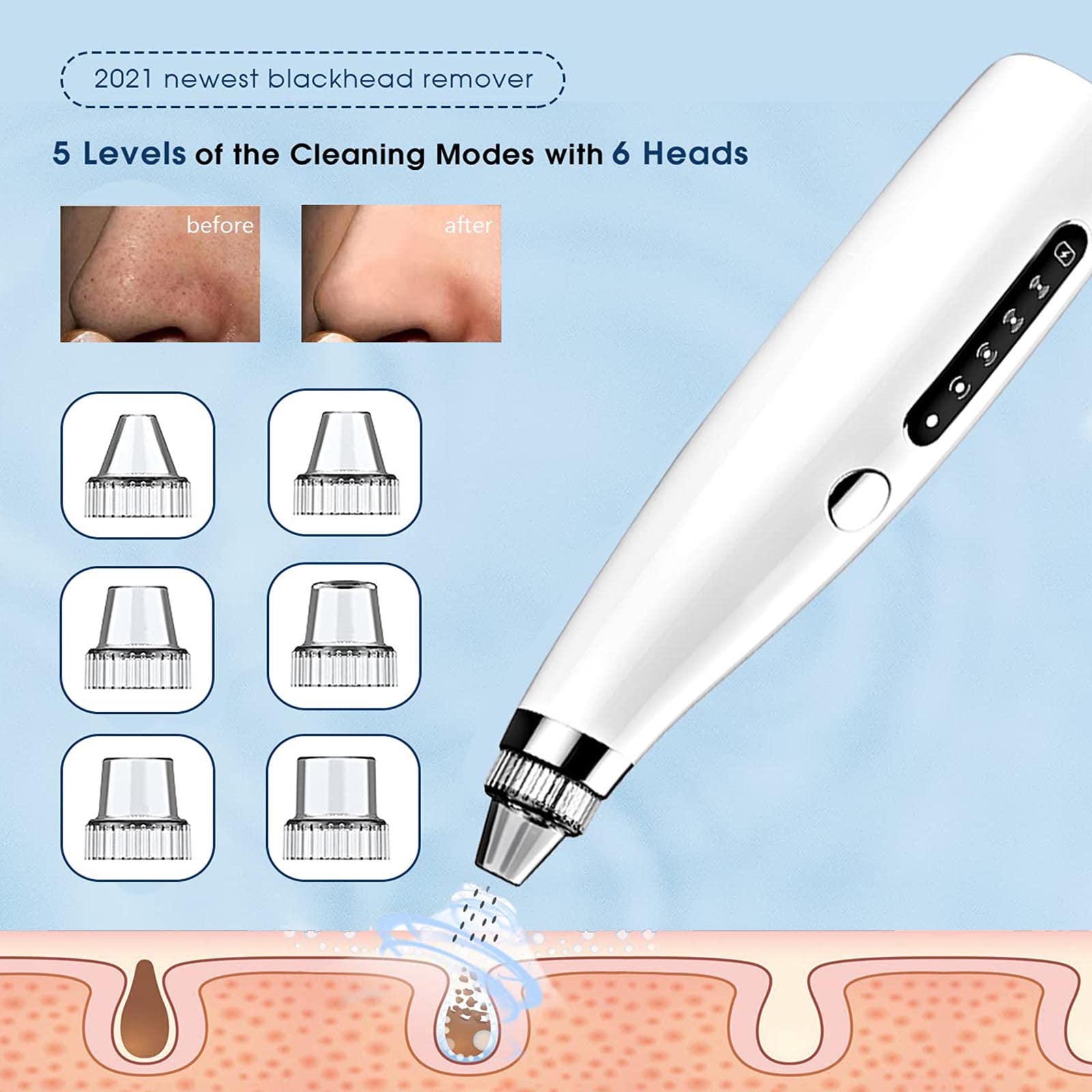 Aspirador facial eléctrico para poros – Aspirador de poros para eliminar puntos negros, limpiador de poros faciales, herramienta de succión de puntos negros, herramienta extractora de puntos blancos