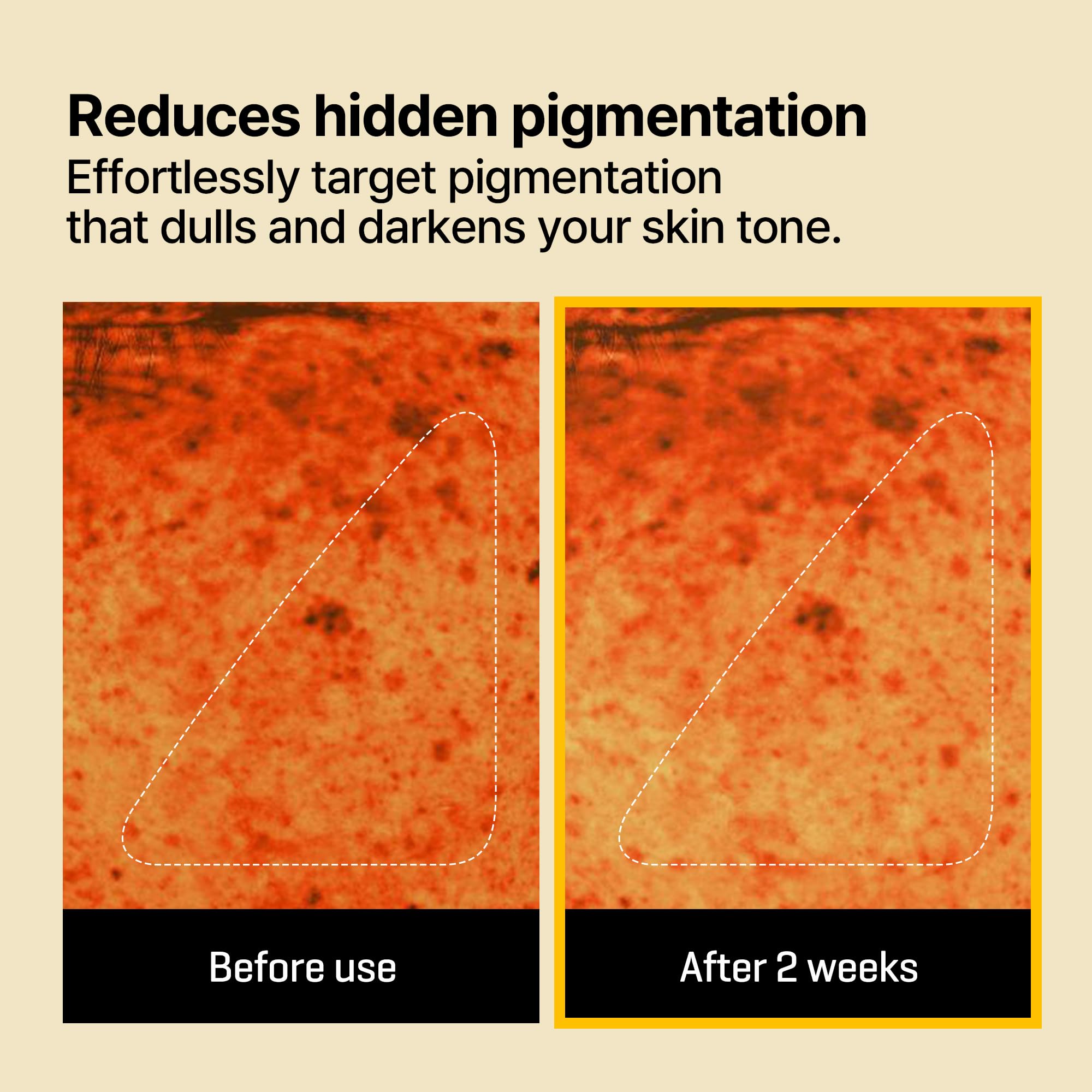 SOME BY MI Yuja Niacin Anti Blemish Daily Mask, 30 Sheets, 11.8oz, Daily Korean Niacinamide Face Sheet Mask for Dark Spot - Image 4