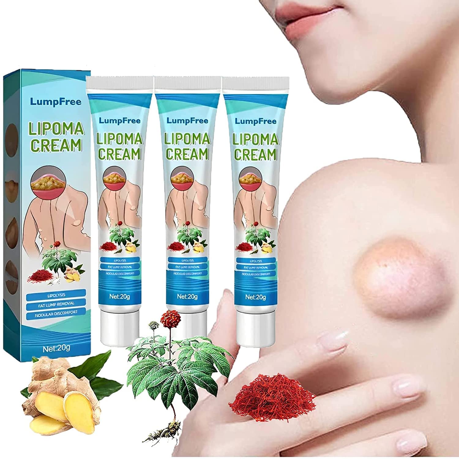 LumpFree Lipoma Removal Cream,Lipoma Cream,Get Rid of Your